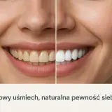 Przed i po higienizacji zębów: od żółtawych do olśniewająco białych. Efekty, które dodają pewności siebie.