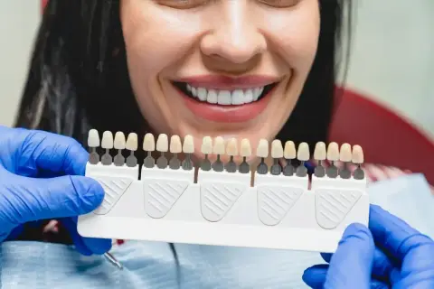 Uśmiechnięta kobieta z idealnymi zębami, dentysta pokazuje paletę kolorów do wyboru najtańszych licówek na zęby.