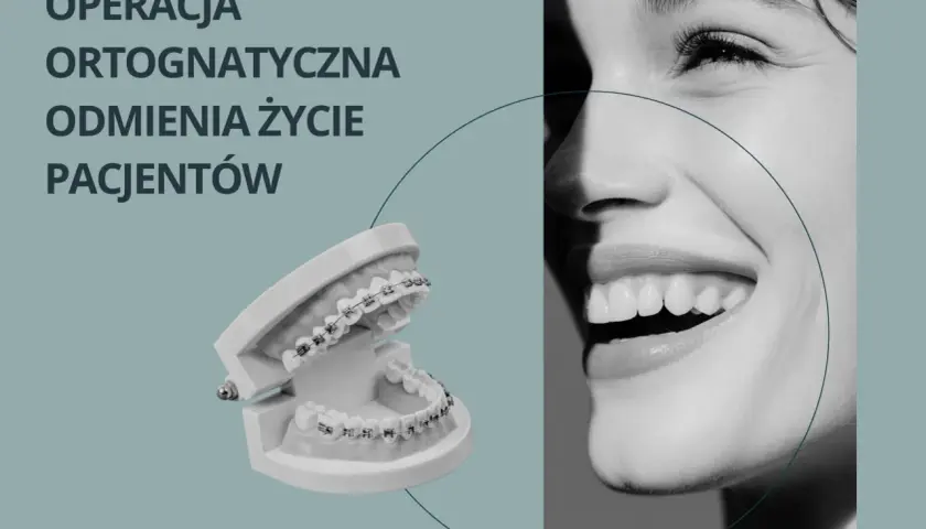 Model szczęki z aparatem ortodontycznym i uśmiechnięta twarz. Operacja ortognatyczna odmienia życie pacjentów.