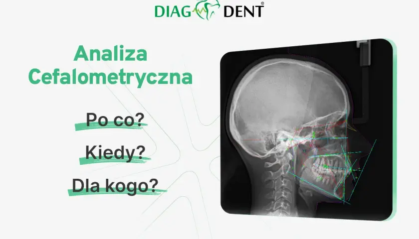 Analiza cefalometryczna: zdjęcie RTG czaszki z naniesionymi liniami i punktami pomiarowymi. Pytania: Po co? Kiedy? Dla kogo?
