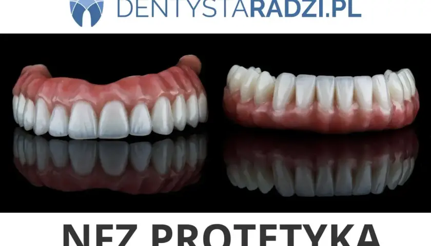 Dwie protezy zębowe, górna i dolna, prezentują estetyczny uśmiech. Dowiedz się, ile kosztuje proteza zębowa natychmiastowa.