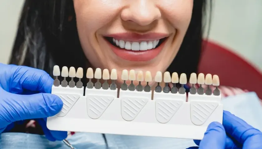 Uśmiechnięta kobieta z idealnymi zębami, dentysta dobiera kolor licówek porcelanowych. Sprawdź, jaka jest licówki porcelanowe cena.