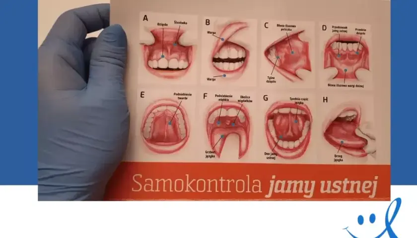 Rak dziąseł: objawy. Czy Twoje dziąsła mówią Ci coś ważnego?