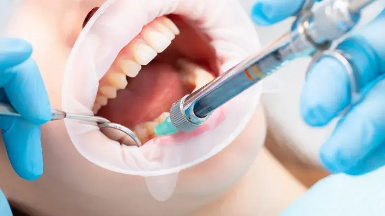 Znieczulenie u dentysty: Bez bólu? Sprawdź, jak to działa krok po kroku!