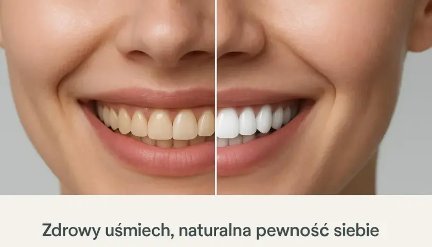Porównanie wybielania zębów przed i po: żółte zęby po lewej, białe po prawej. Uśmiech pełen blasku.
