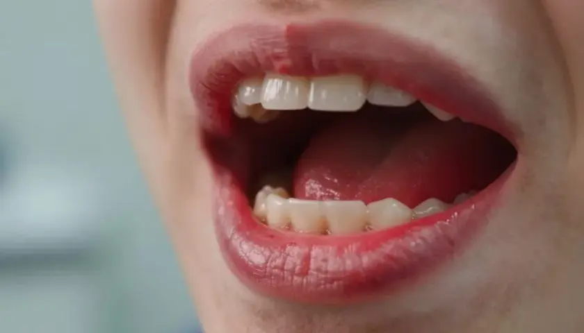 Podrażnione dziąsła? Sprawdzone sposoby i kiedy iść do dentysty